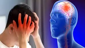 Symptoms and Treatment of Stroke - Ischemic and Hemorrhagic Stroke Care at Lifeline Clinic Dubai