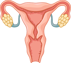 Endometriosis treatment, signs of endometriosis, endometrioma, endometriosis cyst