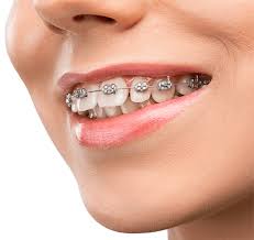 orthodontist in Dubai
